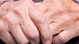 Arthritis